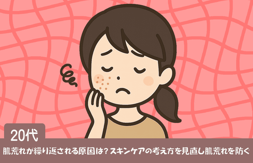 肌荒れが繰り返されるイメージ画像